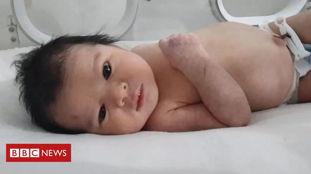 Terremoto na Turquia e na Síria: milhares querem adotar bebê retirada dos escombros - BBC News Brasil
