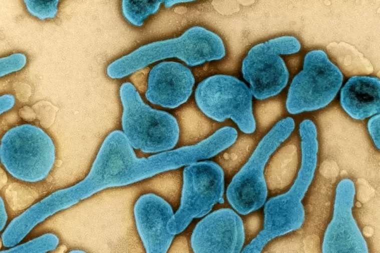 OMS confirma surto do vírus Marburg, com taxa de letalidade de até 88%, na Guiné | O TEMPO