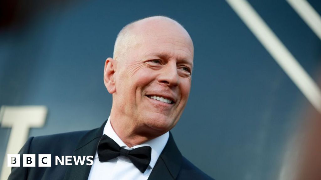 Bruce Willis has frontotemporal dementia - what is it?