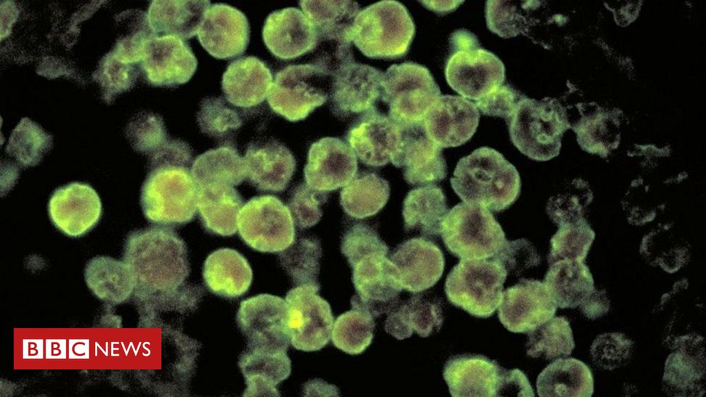 Infecção rara por ameba comedora de cérebro mata homem na Flórida - BBC News Brasil