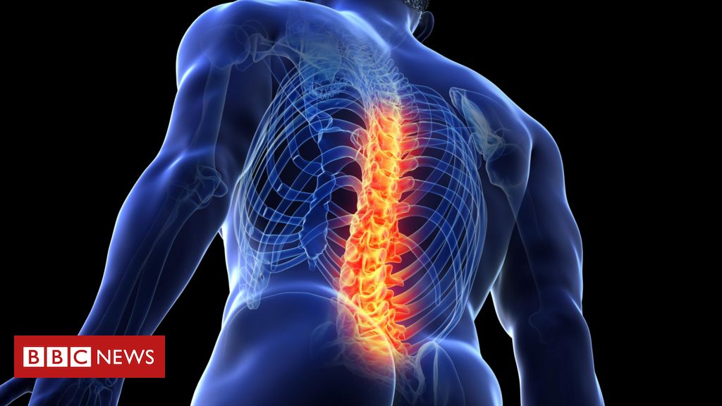 5 coisas que você deveria saber sobre dores nas costas - BBC News Brasil