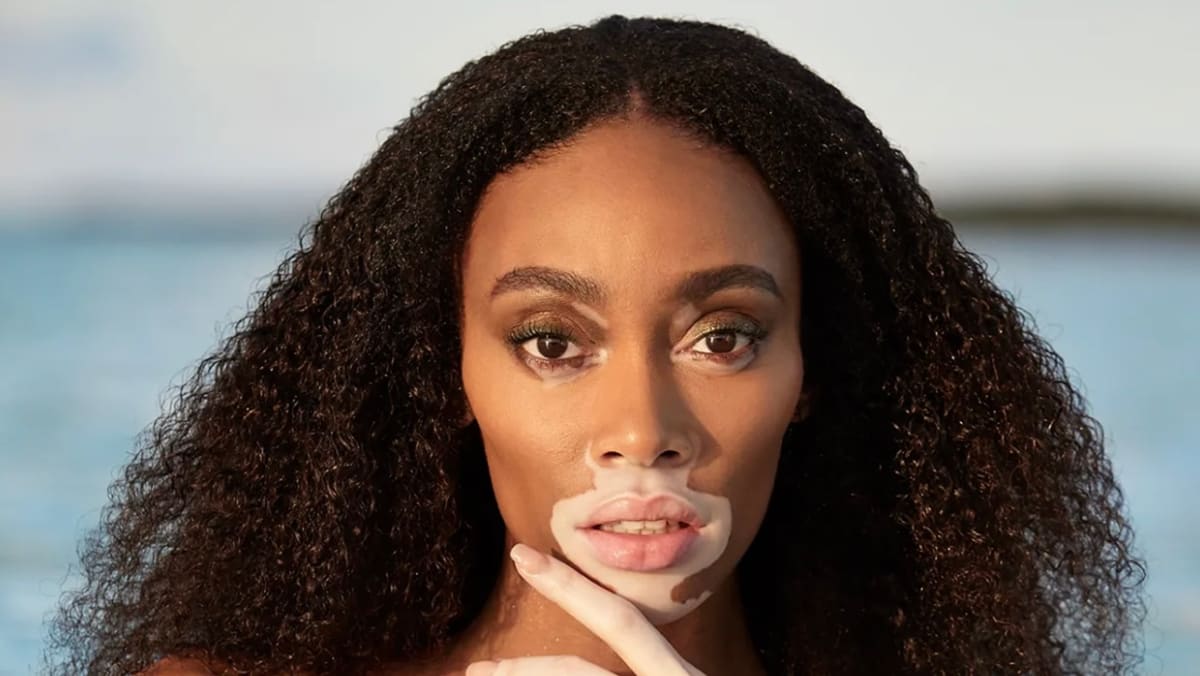 7 Stunning Photos of Cay Skin Founder Winnie Harlow in the Bahamas