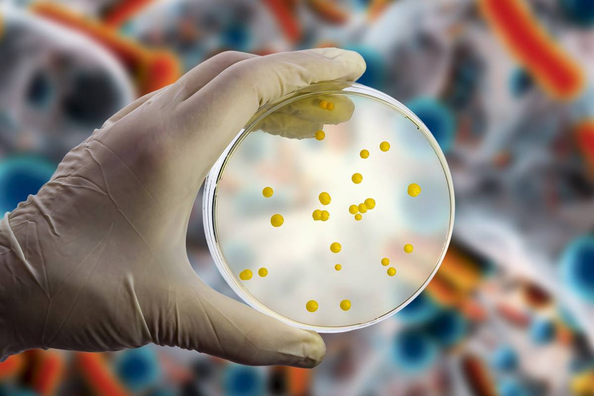 Antibiótico capaz de matar superbactéria é descoberto com ajuda de IA | Metrópoles