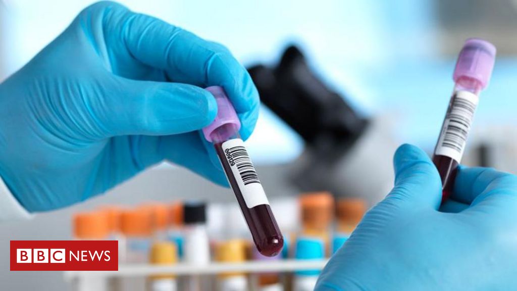 O exame de sangue em teste no Reino Unido que identifica mais de 50 tipos de câncer - BBC News Brasil