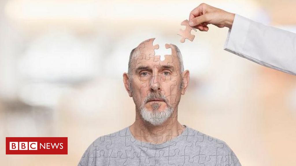 Dia Mundial do Alzheimer: 3 boas notícias recentes para pessoas com demência - BBC News Brasil