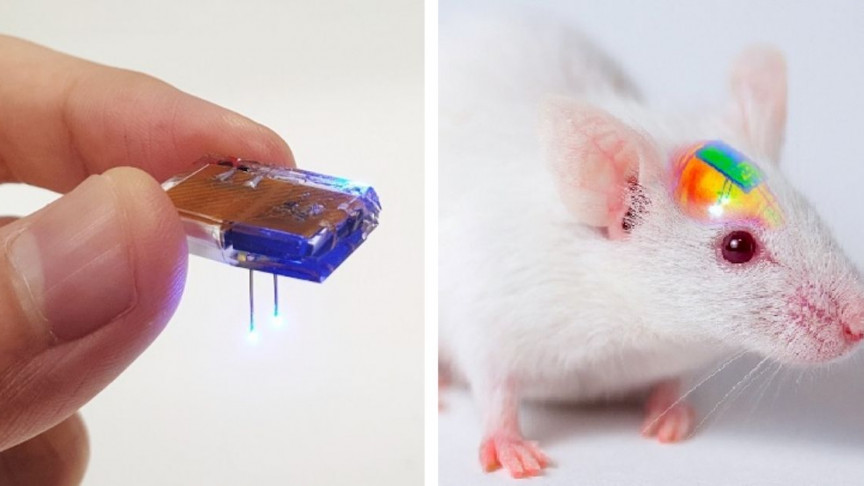Wirelessly Rechargeable Soft Brain Implant Could Cure Brain Diseases