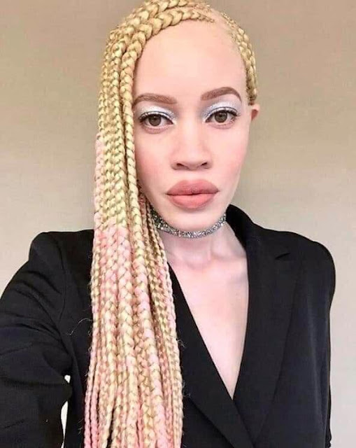 Albinos na África