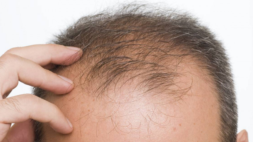 A Cure for Baldness May Lie in Engineering Stem-Cells That Regenerate