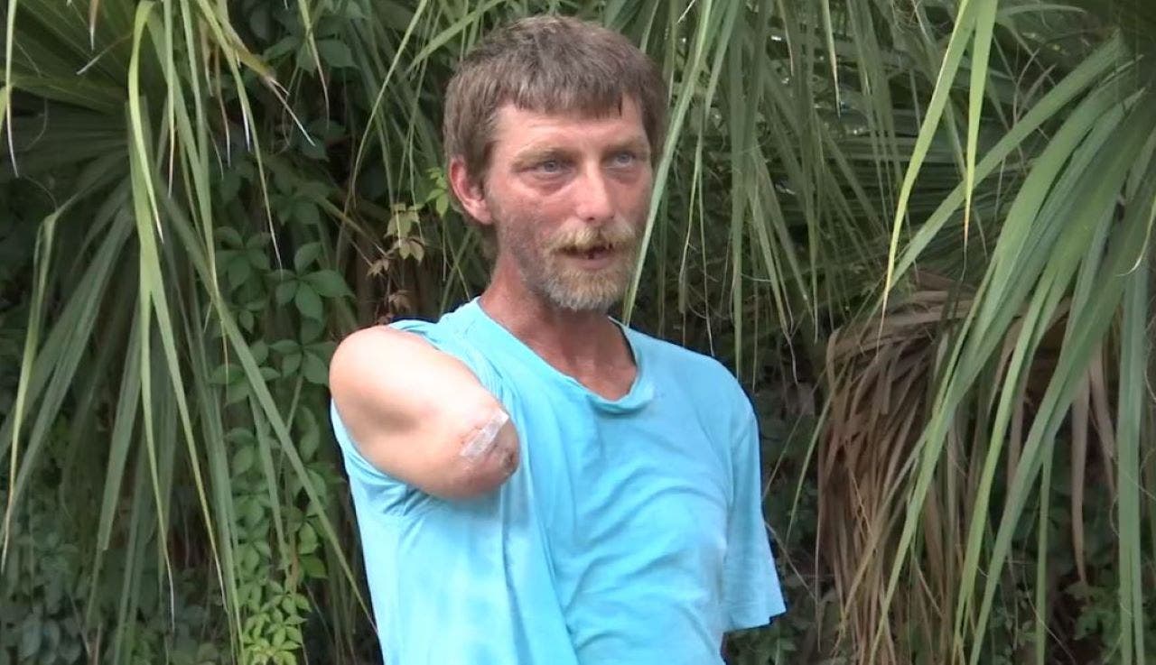 Florida man survives 3 days in swamp after losing arm in alligator attack: 'Do or die'